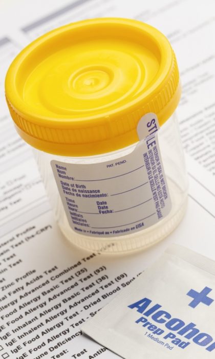 what-is-drug-screening-and-what-does-it-entail-2